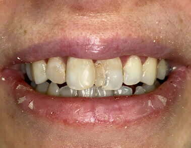 Before image