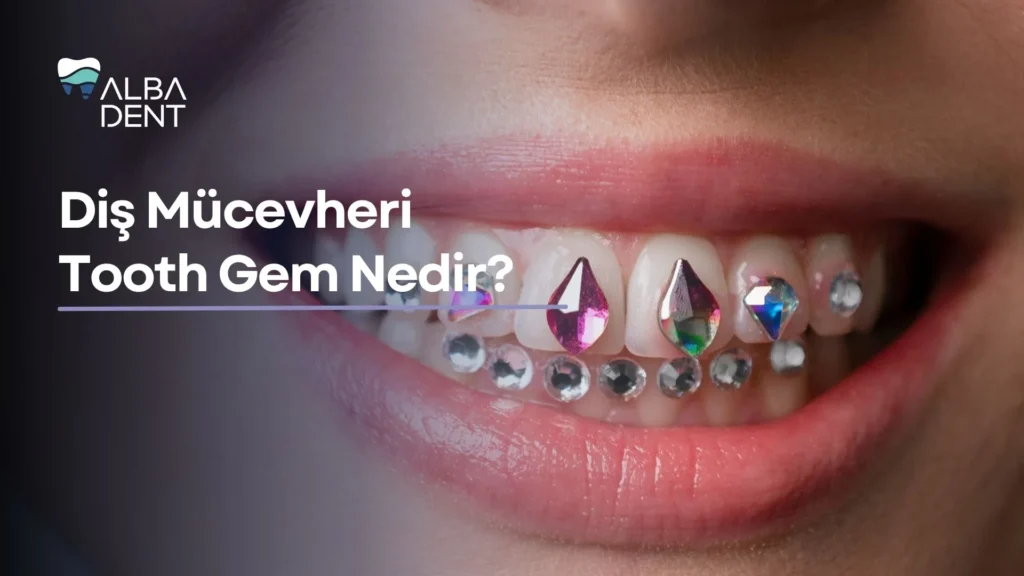 Diş Mücevheri Tooth Gem Nedir