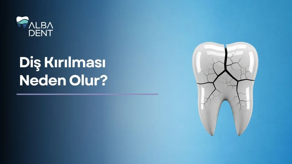 Diş Kırılması Neden Olur?