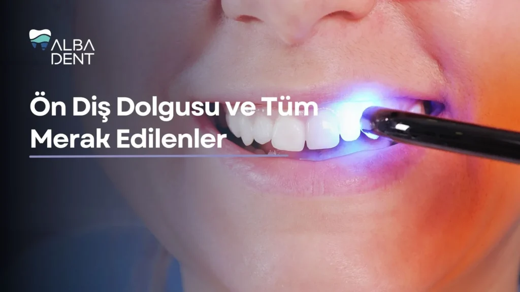 Ön Diş Dolgusu ve Tüm Merak Edilenler